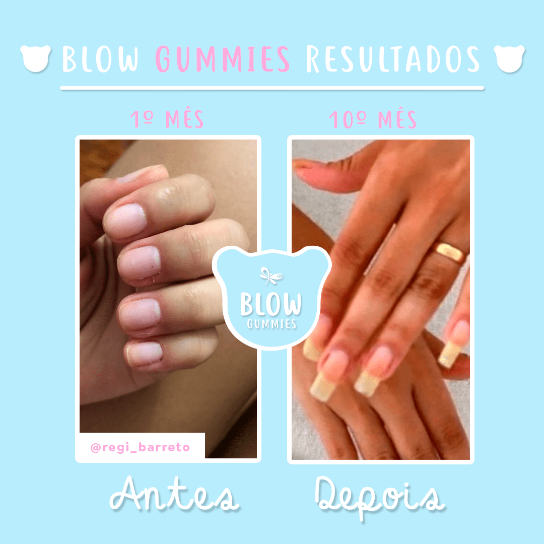 Vitamina Para Unhas Fracas: Conheça A Blow | Blow Gummies